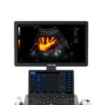 Ultrasound Machine