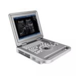 Portable Ultrasound Machine