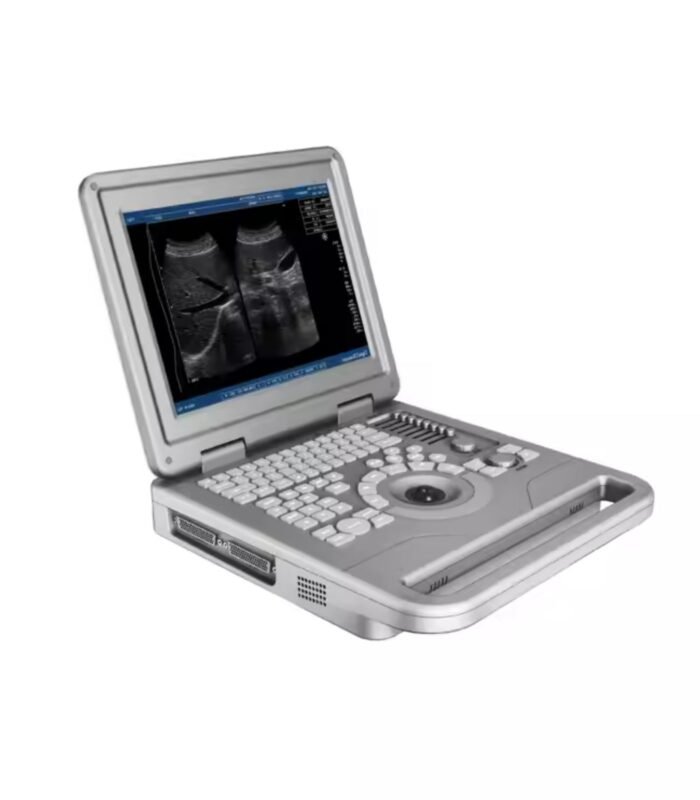 Portable Ultrasound Machine - Image 1