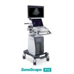 SonoScape P15 – Enhance Your Ultrasound Exam