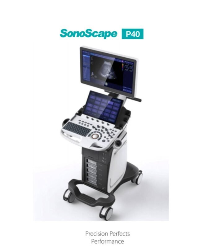 SonoScape P40 – Precision Perfects Performance - Image 1